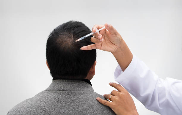 istock Doctor inject treatment serum vitamins hair fall 1126580986