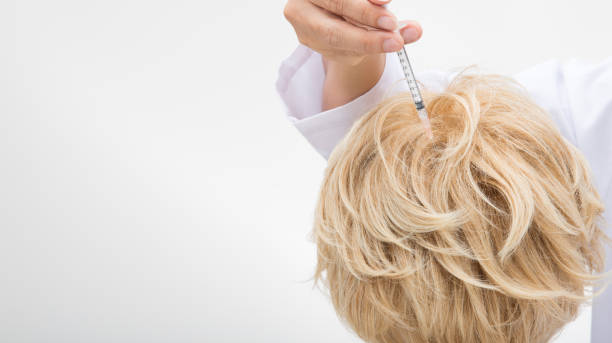 istock Doctor inject treatment serum vitamins hair fall 1126581046