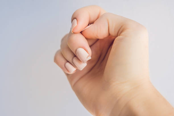 Broken nail on a woman's hand with a manicure on a green background stock photo