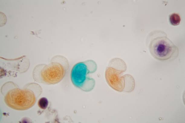 istock Pollen grains of different species under the microscope 1126688722