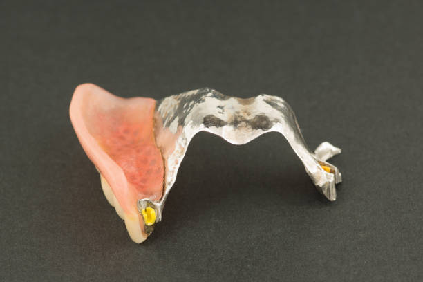 istock large image of a modern arc denture with attachmens 1126920300