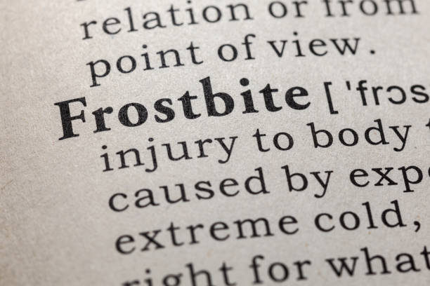 istock definition of frostbite 1126975390