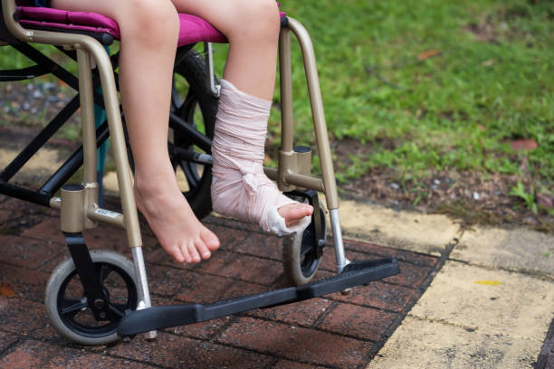 istock Leg broken child sit on wheelchair 1127073707