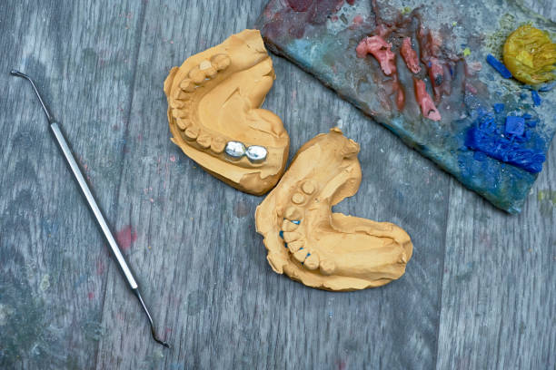 istock A pair of artificial ceramic dentures on the table 1127089091
