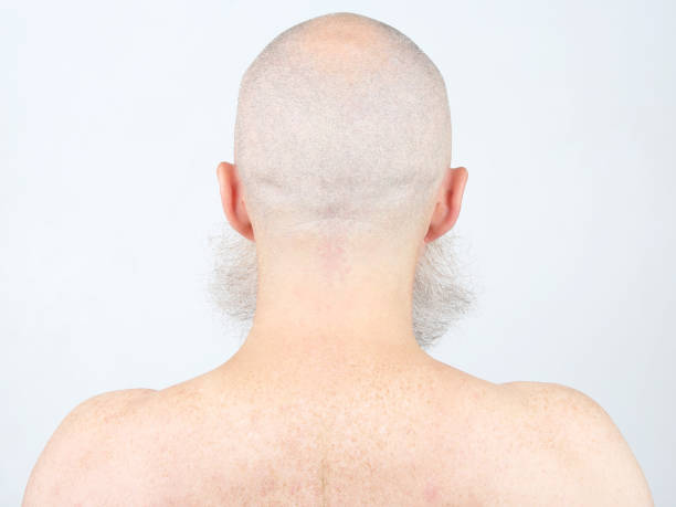 istock portrait of bald man with beard from back on light background 1127106278
