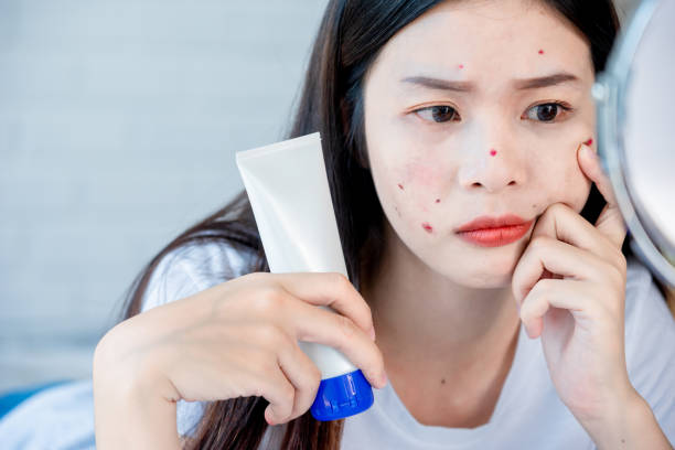 istock Asian teenage woman  looking at mirror and squeeze acne problem on her face 1127127672