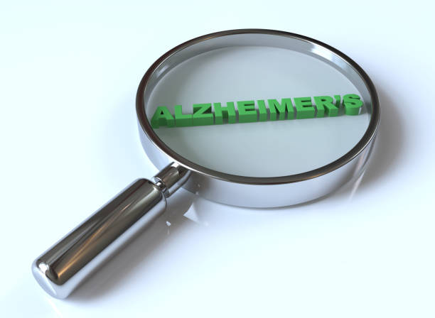 choroba alzheimera - alzheimers disease brain healthcare and medicine aging process zdjęcia i obrazy z banku zdjęć