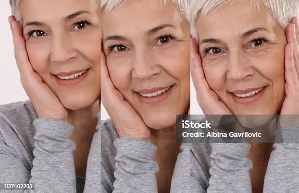 Aging Process Concept Antiaging Procedures Facial Lifting Old And Young Skin Compare Stock Photo - Download Image Now