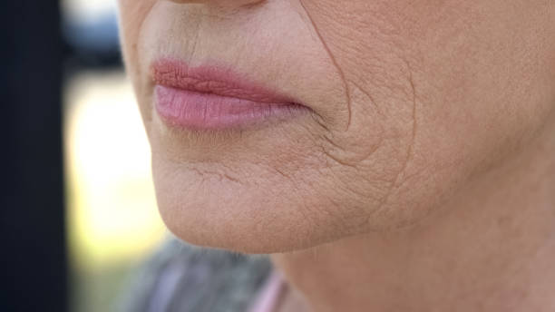 Wrinkled face of elderly woman, cosmetological injections, plastic surgery stock photo