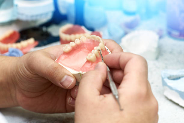 zahnarzt macht eine zahnimplantat-prothese - laboratory dentures dental hygiene human teeth stock-fotos und bilder