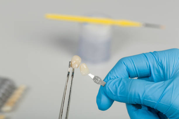 istock checking correct verneer of artificial dentition with a shade guide  in a dental laboratory 1127542967