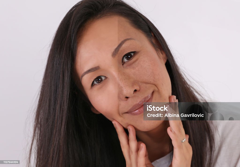 Rostro De La Mujer Antes Y Después De La Comparación De La Profesional Del Maquillaje Cubrir Cicatrices De Espinillas Y Acné Con Base En Polvo Foto de stock y más banco de Rostro De La Mujer Antes Y Después De La Comparación De La Profesional Del Maquillaje Cubrir Cicatrices De Espinillas Y Acné Con Base En Polvo Foto de stock y más banco de