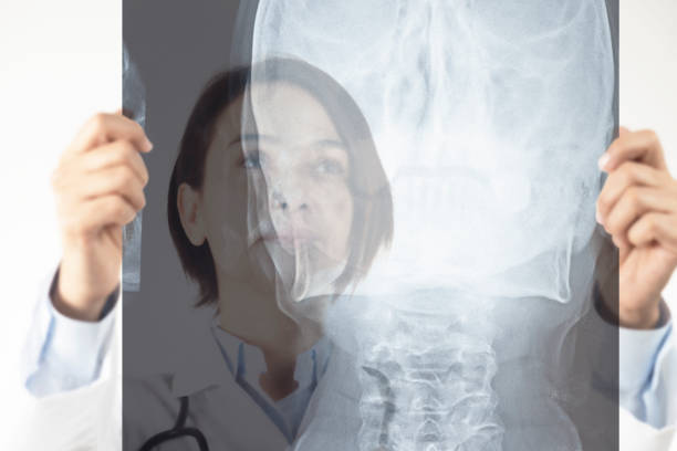 istock Female doctor looking at X-Ray 1127614879