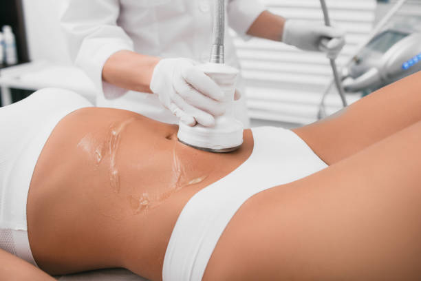 beautiful woman having cavitation , cellulite treatment, on her belly at beauty clinic - alternative therapy massaging clinic health spa imagens e fotografias de stock