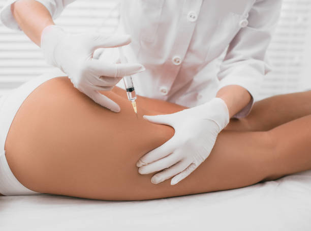 esthéticienne, faire l’injection en gros plan de fesses féminines - mesotherapy photos et images de collection