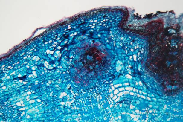 istock Cells of a plant stem with a disease under a microscope 1127993586