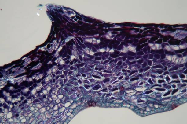 istock Plant cells infected by a plant parasite under the microscope 1127995363