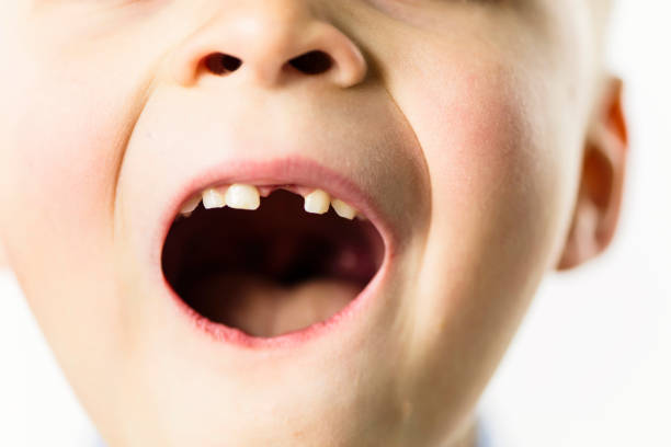 istock mouth without front tooth of funny boy 1128050159