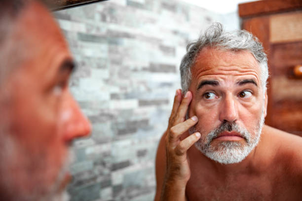istock Sunburned Mature Man looking into the Mirror in the bathroom 1128066185