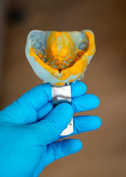 istock Dentist dental teeth impression mold with compoundDental Silicon Impression 1128181997