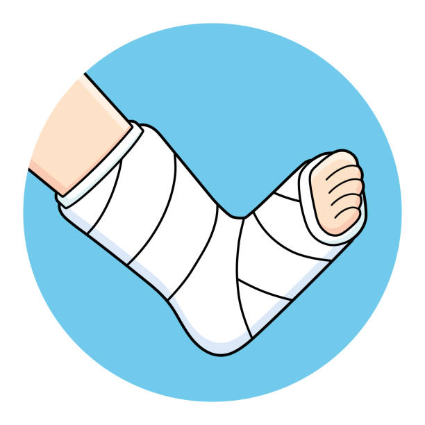 135 Broken Leg Cast Illustrations & Clip Art - iStock | Man broken leg cast