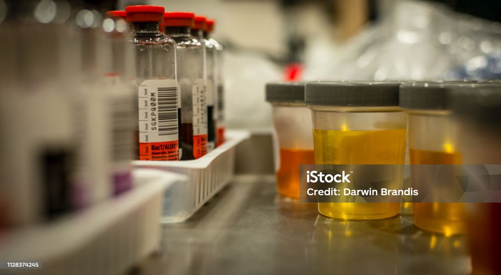 Urine Samples Urine samples in a biotechnology lab.

+++NOTE TO EDITOR+++

Barcodes and numbers are randomly generated and not personal information. Urine Sample Stock Photo
