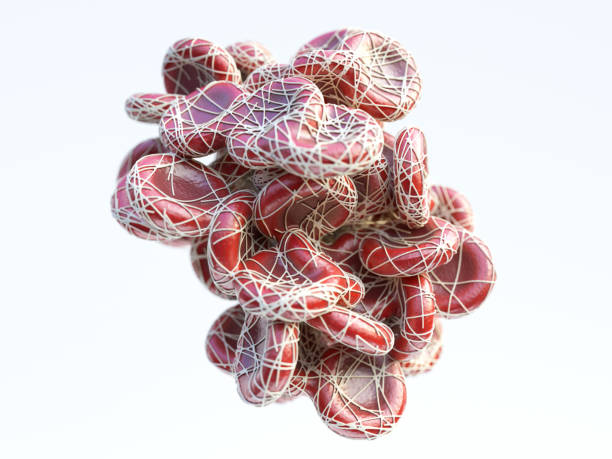istock Closeup of a atherosclerosis- 3D rendering 1128451288