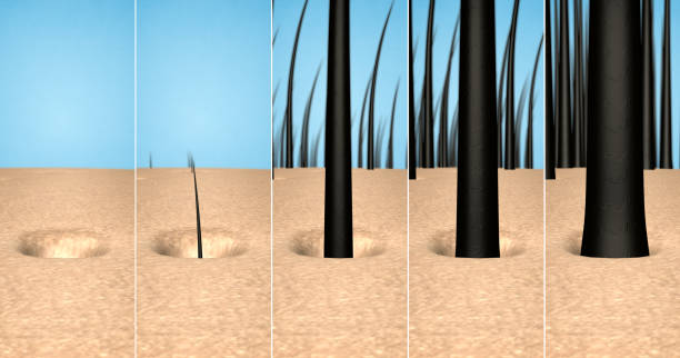 Hair Care - 3D - Hair Reforestation