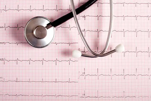 Photo of cardiology stethoscope and graphs