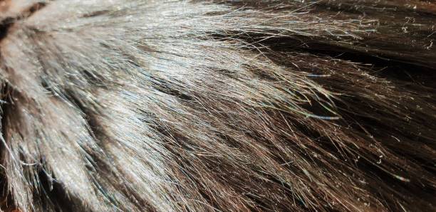 istock Cat hair. Woolen. Wool cat close up. 1128505766