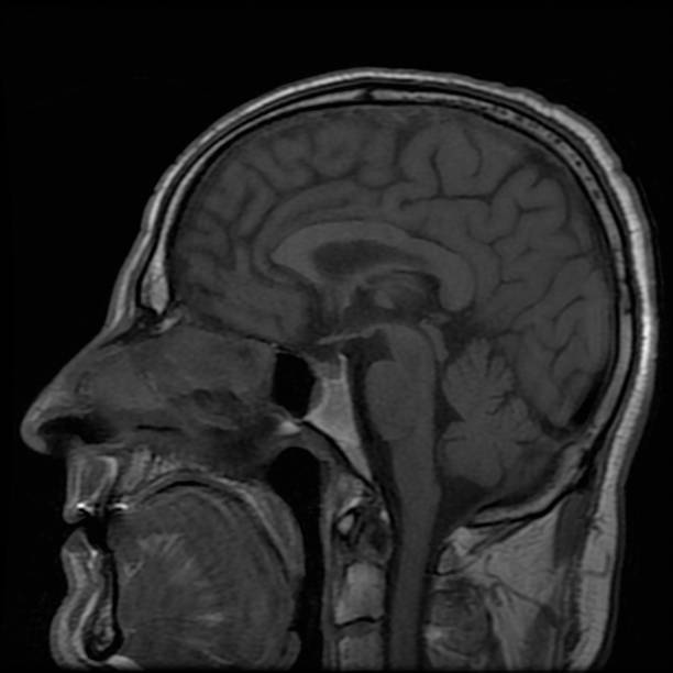 istock Medical Imaging of Human Head - Brain MRI (Magnetic Resonance) High Resolution 1128538112