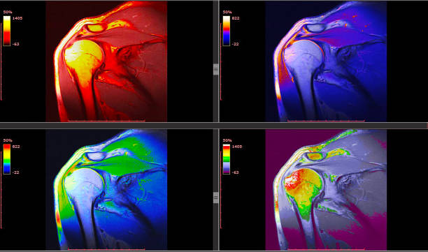人間の筋骨格系システム-肩の mri (磁気共鳴画像) 高分解能放射線計測 - mri scanner healthcare and medicine medical exam brain ストックフォトと画像