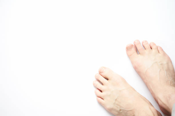 istock The naked man's feet on white background in studio. 1128634316