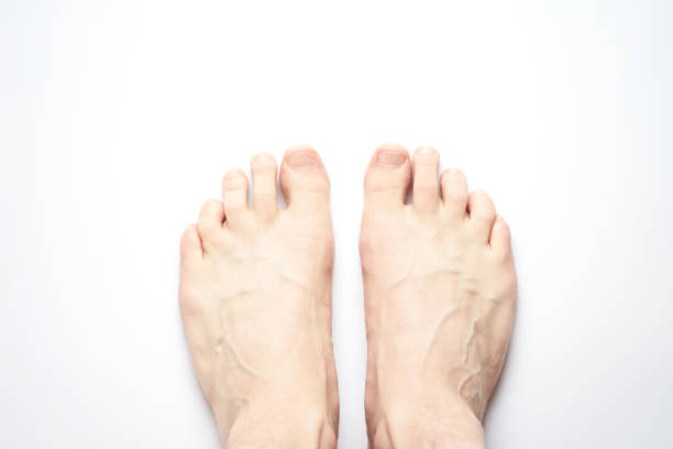 istock The naked man's feet on white background in studio. Top view. 1128634317