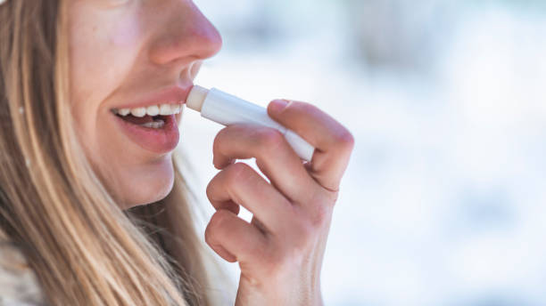 porträt des jungen weiblichen anwendung lippenbalsam im winter. - lip balm stock-fotos und bilder