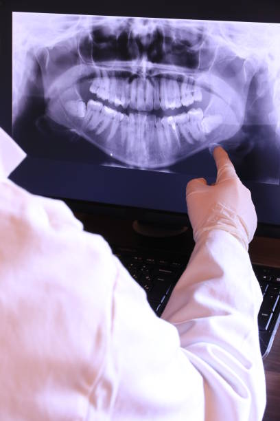 istock Dentist examining Dental x-ray 1128719532