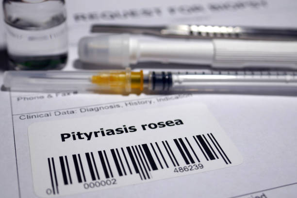 istock Pityriasis rosea biopsy 1128839078