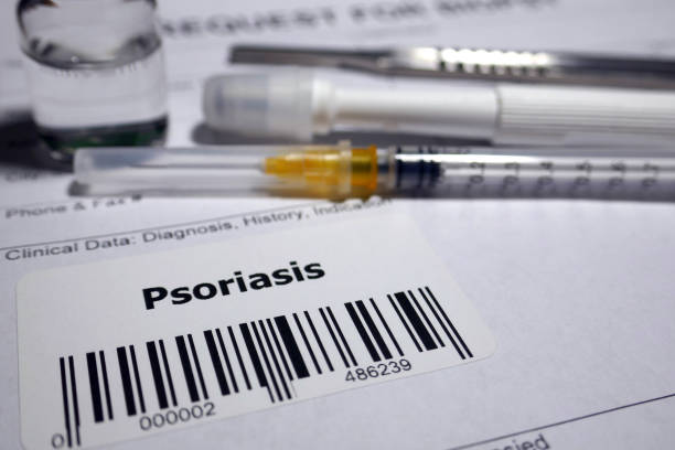 biopsia de la psoriasis - medical sample pathologist laboratory healthcare and medicine fotografías e imágenes de stock