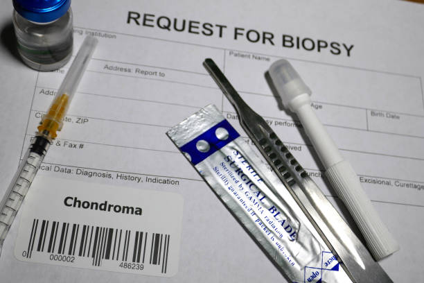 biopsja chondroma - chondroma zdjęcia i obrazy z banku zdjęć