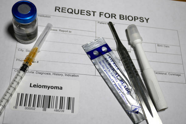 istock Leiomyoma biopsy 1128839289