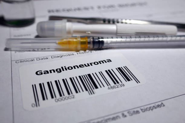 istock Ganglioneuroma 1128841256