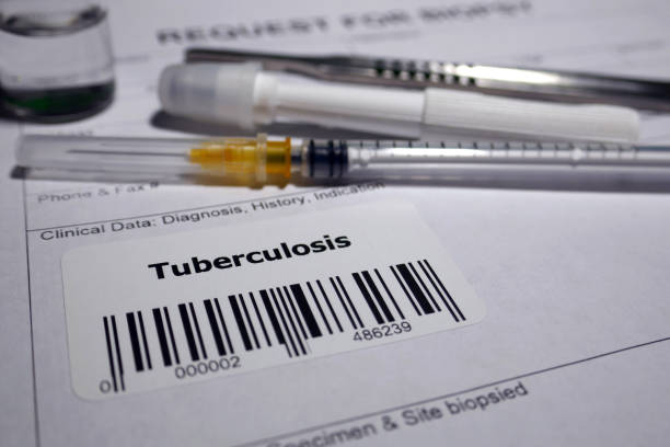 tubercolosi - medical sample pathologist laboratory healthcare and medicine foto e immagini stock