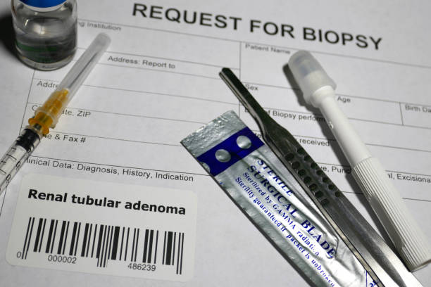 istock Renal Tubular Adenoma biopsy 1128842931