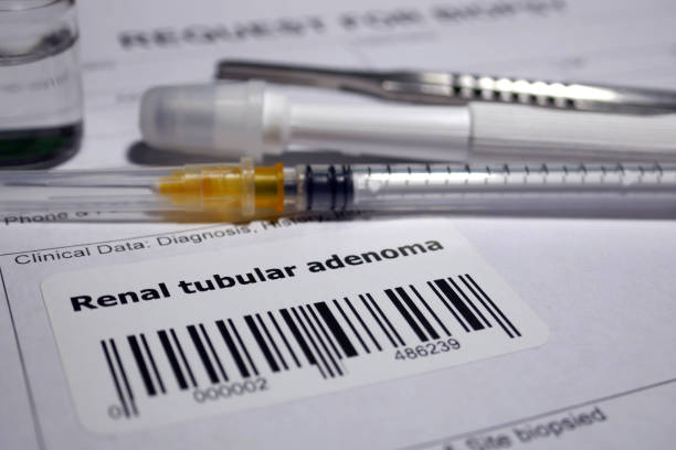 istock Renal tubular adenoma biopsy 1128843677