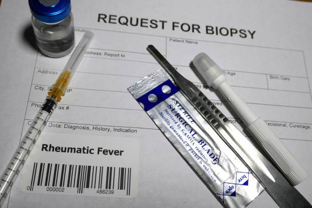 istock Rheumatic fever biopsy 1128843819