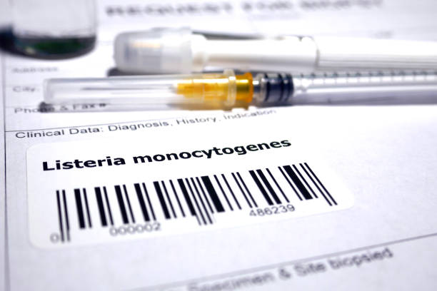Listeria monocytogenes stock photo