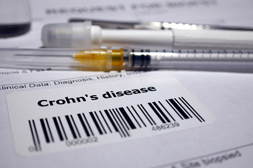 Request for biopsy - Crohn's disease