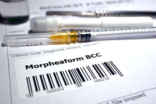 Request for biopsy - Morpheaform Basal-cell carcinoma