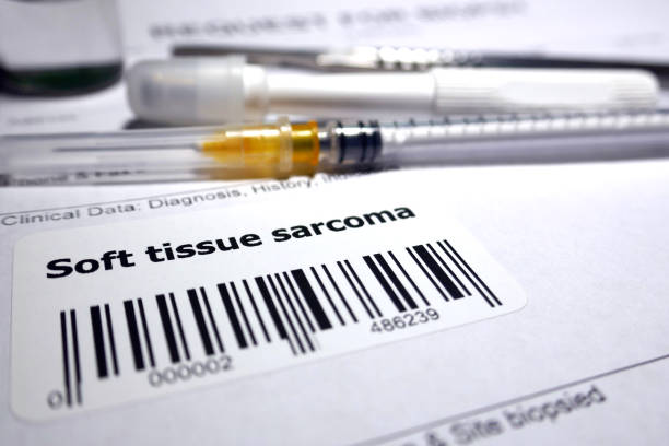 sarcoma dei tessuti molli - medical sample pathologist laboratory healthcare and medicine foto e immagini stock