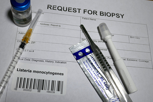 Request for biopsy - Listeria monocytogenes